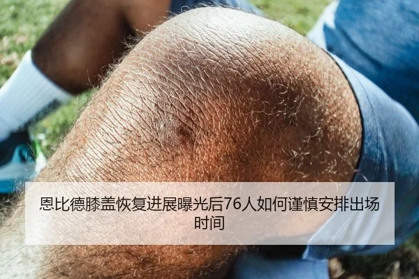 恩比德膝盖恢复进展曝光后76人如何谨慎安排出场时间